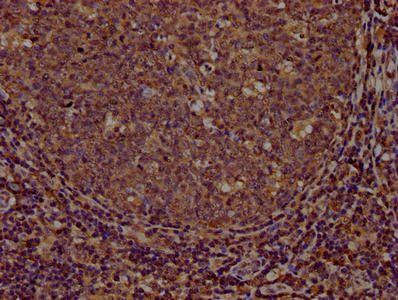 IHC image of CD44 Monoclonal Antibody diluted at 1:100 and staining in paraffin-embedded human tonsil tissue performed on a Leica BondTM system. After dewaxing and hydration, antigen retrieval was mediated by high pressure in a citrate buffer (pH 6.0). Section was blocked with 10% normal goat serum 30min at RT. Then primary antibody (1% BSA) was incubated at 4°C overnight. The primary is detected by a biotinylated secondary antibody and visualized using an HRP conjugated SP system.