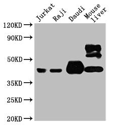 Western Blot Positive WB detected in: Jurkat whole cell lysate, Raji whole cell lysate, Daudi whole cell lysate, Mouse liver tissue  All lanes: CD48 antibody at 1:4000 Secondary Goat polyclonal to mouse IgG at 1/50000 dilution Predicted band size: 28, 20KDa Observed band size: 43 KDa Exposure time:5min