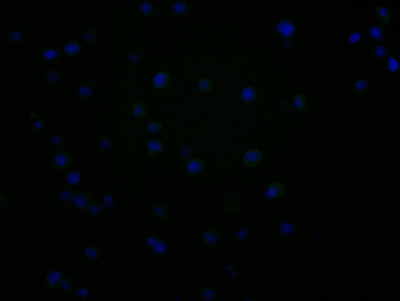 Immunofluorescence staining of JK cells with CD48 Monoclonal Antibody at 1:100, counter-stained with DAPI. The cells were fixed in 4% formaldehyde and blocked in 10% normal Goat Serum. The cells were incubated with the antibody overnight at 4°C. Nuclear DNA was labeled in blue with DAPI. The secondary antibody was FITC-conjugated AffiniPure Goat Anti-Mouse IgG (H+L).