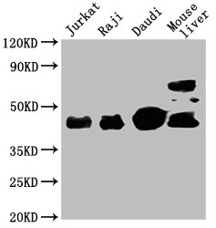 Western Blot Positive WB detected in: Jurkat whole cell lysate, Raji whole cell lysate, Daudi whole cell lysate, Mouse liver tissue  All lanes: CD48 antibody at 1:2000 Secondary Goat polyclonal to mouse IgG at 1/50000 dilution Predicted band size: 28, 20 KDa Observed band size: 43 KDa Exposure time:5min