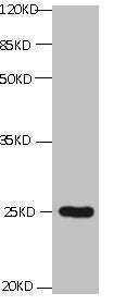 All lanes: Mouse Anti-CD59 monoclonal antibody at 1μg/ml | Lane 1:K562 | Predicted band size : 15kd | Observed band size : 22kd