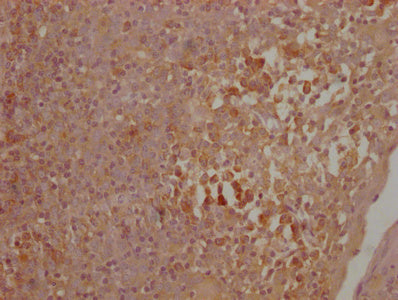 IHC image of CTLA4 Monoclonal Antibody diluted at 1:500 and staining in paraffin-embedded human lymph node tissue performed on a Leica BondTM system. After dewaxing and hydration, antigen retrieval was mediated by high pressure in a citrate buffer (pH 6.0). Section was blocked with 10% normal goat serum 30min at 37°C Then primary antibody (1% BSA) was incubated at 4°C overnight. The primary is detected by a Goat anti-Mouse IgG labeled by HRP and visualized using 0.05% DAB.