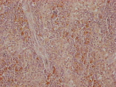 IHC image of CTLA4 Monoclonal Antibody diluted at 1:500 and staining in paraffin-embedded human tonsil tissue performed on a Leica BondTM system. After dewaxing and hydration, antigen retrieval was mediated by high pressure in a citrate buffer (pH 6.0). Section was blocked with 10% normal goat serum 30min at 37°C Then primary antibody (1% BSA) was incubated at 4°C overnight. The primary is detected by a Goat anti-Mouse IgG labeled by HRP and visualized using 0.05% DAB.