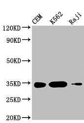 Western Blot Positive WB detected in: CEM whole cell lysate, K562 whole cell lysate, Raji whole cell lysate  All lanes: CTLA4 antibody at 1:1000 Secondary Goat polyclonal to mouse IgG at 1/50000 dilution Predicted band size: 25, 7, 9, 20 KDa Observed band size: 34 KDa Exposure time:5min