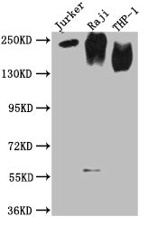 Western Blot  | Positive WB detected in: Jurkat whole cell lysate, Raji whole cell lysate, THP-1 whole cell lysate  | All lanes CD45 antibody at 1:2000  | Secondary  | Goat polyclonal to mouse IgG at 1/50000 dilution  | Predicted band size: 148, 132, 143, 141, 139, 136 KDa  | Observed band size: 180-250 KDa  | Exposure time:15min