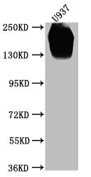 Western Blot  | Positive WB detected in: U937 whole cell lysate  | All lanes CD45 antibody at 1:2000  | Secondary  | Goat polyclonal to mouse IgG at 1/50000 dilution  | Predicted band size: 148, 132, 143, 141, 139, 136 KDa  | Observed band size: 180-250 KDa  | Exposure time:5min