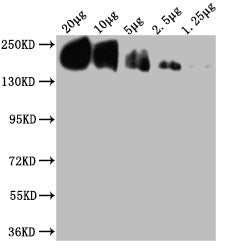 Western Blot  | Positive WB detected in: THP-1whole cell lysate at 20μg, 10μg, 5μg, 2.5μg, 1.25μg All lanes: CD45 antibody at 1:2000  | Secondary  | Goat polyclonal to mouse IgG at 1/50000 dilution  | Predicted band size: 148, 132, 143, 141, 139, 136 KDa  | Observed band size: 180-250 KDa  | Exposure time:15min