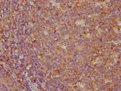 IHC image of PD-L1 Monoclonal Antibody diluted at 1:100 and staining in paraffin-embedded human tonsil tissue performed on a Leica BondTM system. After dewaxing and hydration, antigen retrieval was mediated by high pressure in a citrate buffer (pH 6.0). Section was blocked with 10% normal goat serum 30min at RT. Then primary antibody (1% BSA) was incubated at 4°C overnight. The primary is detected by a biotinylated secondary antibody and visualized using an HRP conjugated SP system.