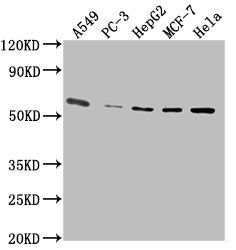 Western Blot  | Positive WB detected in: A549 whole cell lysate, PC-3 whole cell lysate, HepG2 whole cell lysate, MCF-7 whole cell lysate, Hela whole cell lysate  | All lanes: PD-L1 antibody at 1:2500  | Secondary  | Goat polyclonal to Mouse IgG at 1/10000 dilution  | Predicted band size: 34, 21 kDa  | Observed band size: 55 kDa