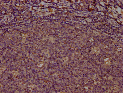 IHC image of PD-L1 Monoclonal Antibody diluted at 1:100 and staining in paraffin-embedded human tonsil tissue performed on a Leica BondTM system. After dewaxing and hydration, antigen retrieval was mediated by high pressure in a citrate buffer (pH 6.0). Section was blocked with 10% normal goat serum 30min at RT. Then primary antibody (1% BSA) was incubated at 4°C overnight. The primary is detected by a biotinylated secondary antibody and visualized using an HRP conjugated SP system.