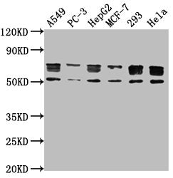 Western Blot  | Positive WB detected in: A549 whole cell lysate, PC-3 whole cell lysate, HepG2 whole cell lysate, MCF-7 whole cell lysate, 293 whole cell lysate, Hela whole cell lysate  | All lanes: PD-L1 antibody at 1:1000  | Secondary  | Goat polyclonal to Mouse IgG at 1/10000 dilution  | Predicted band size: 34, 21 kDa  | Observed band size: 55, 70 kDa