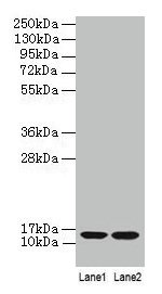 Western blot  | All lanes: B2M antibody at 2µg/ml  | Lane 1: A431 whole cell lysate  | Lane 2: Mouse lung tissue  | Secondary  | Goat polyclonal to rabbit IgG at 1/10000 dilution  | Predicted band size: 14 kDa  | Observed band size: 14 kDa