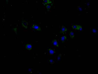 Immunofluorescence staining of Hela cell with BTN3A1 Antibody at 1:20, counter-stained with DAPI. The cells were fixed in 4% formaldehyde and blocked in 10% normal Goat Serum. The cells were then incubated with the antibody overnight at 4C. The secondary antibody was Alexa Fluor 488-congugated AffiniPure Goat Anti-Rabbit IgG(H+L).