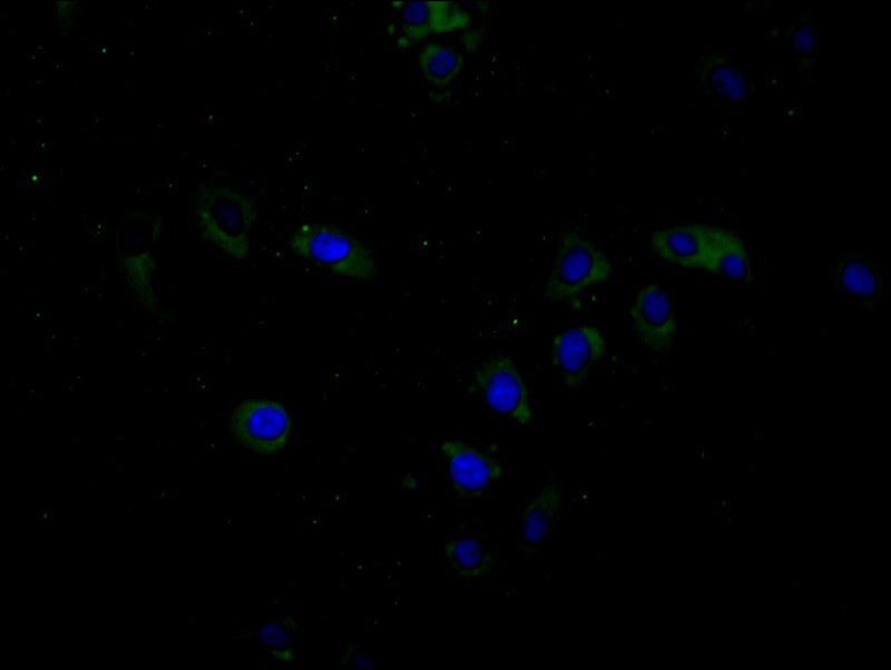 Immunofluorescence staining of Hela cell with BTN3A1 Antibody at 1:20, counter-stained with DAPI. The cells were fixed in 4% formaldehyde and blocked in 10% normal Goat Serum. The cells were then incubated with the antibody overnight at 4C. The secondary antibody was Alexa Fluor 488-congugated AffiniPure Goat Anti-Rabbit IgG(H+L).