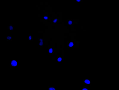 Immunofluorescence staining of Hela cell with 5% goat serum, counter-stained with DAPI. The cells were fixed in 4% formaldehyde and blocked in 10% normal Goat Serum. The cells were then incubated with the antibody overnight at 4C. The secondary antibody was Alexa Fluor 488-congugated AffiniPure Goat Anti-Rabbit IgG(H+L).