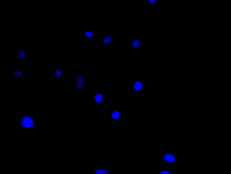 Immunofluorescence staining of Hela cell with 5% goat serum, counter-stained with DAPI. The cells were fixed in 4% formaldehyde and blocked in 10% normal Goat Serum. The cells were then incubated with the antibody overnight at 4C. The secondary antibody was Alexa Fluor 488-congugated AffiniPure Goat Anti-Rabbit IgG(H+L).