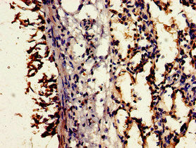 Immunohistochemistry of paraffin-embedded human lung tissue using the antibody at dilution of 1:100