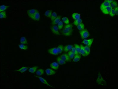 Immunofluorescence staining of PC-3 cells with CD59 Antibody at 1:133, counter-stained with DAPI. The cells were fixed in 4% formaldehyde, permeabilized using 0.2% Triton X-100 and blocked in 10% normal Goat Serum. The cells were then incubated with the antibody overnight at 4°C. The secondary antibody was Alexa Fluor 488-congugated AffiniPure Goat Anti-Rabbit IgG(H+L).