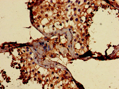 Immunohistochemistry of paraffin-embedded human testis tissue using CD59 Antibody at dilution of 1:100