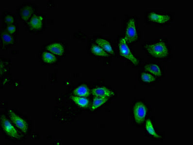 Immunofluorescent analysis of HepG2 cells using CD79A Antibody at dilution of 1:100 and Alexa Fluor 488-congugated AffiniPure Goat Anti-Rabbit IgG(H+L)