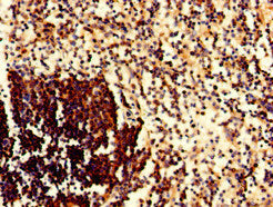 Immunohistochemistry of paraffin-embedded human spleen tissue using CD79A Antibody at dilution of 1:100