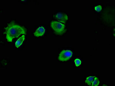 Immunofluorescence staining of MCF-7 cells with CEACAM5 Antibody at 1:133, counter-stained with DAPI. The cells were fixed in 4% formaldehyde, permeabilized using 0.2% Triton X-100 and blocked in 10% normal Goat Serum. The cells were then incubated with the antibody overnight at 4°C. The secondary antibody was Alexa Fluor 488-congugated AffiniPure Goat Anti-Rabbit IgG(H+L).