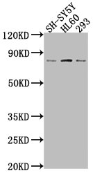 Western Blot | Positive WB detected in: SH-SY5Y whole cell lysate, HL60 whole cell lysate, 293 whole cell lysate | All lanes: CEACAM5 antibody at 1:2000 | Secondary | Goat polyclonal to rabbit IgG at 1/50000 dilution | Predicted band size: 77 kDa | Observed band size: 77 kDa