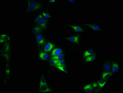 Immunofluorescence staining of Hela cells with the antibody at 1:200, counter-stained with DAPI. The cells were fixed in 4% formaldehyde, permeabilized using 0.2% Triton X-100 and blocked in 10% normal Goat Serum. The cells were then incubated with the antibody overnight at 4°C. The secondary antibody was Alexa Fluor 488-congugated AffiniPure Goat Anti-Rabbit IgG(H+L).