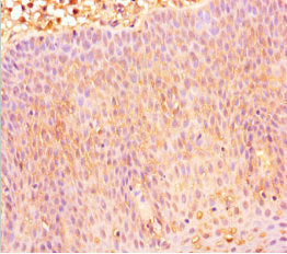 Immunohistochemistry of paraffin-embedded human tonsil tissue using CXCR4 Antibody at dilution of 1:100