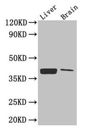 Western Blot  | Positive WB detected in: Mouse liver tissue, Mouse brain tissue  | All lanes: CXCR4 antibody at 2.6µg/ml  | Secondary  | Goat polyclonal to rabbit IgG at 1/50000 dilution  | Predicted band size: 40, 41 kDa  | Observed band size: 40 kDa