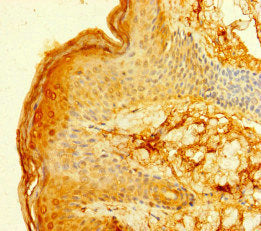 Immunohistochemistry of paraffin-embedded human skin tissue using FCER1A Antibody at dilution of 1:100