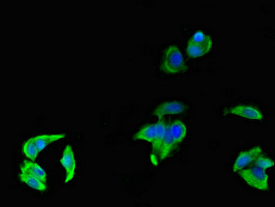 Immunofluorescent analysis of MCF-7 cells using FCGR3A Antibody at dilution of 1:100 and Alexa Fluor 488-congugated AffiniPure Goat Anti-Rabbit IgG(H+L)