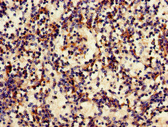 Immunohistochemistry of paraffin-embedded human spleen tissue using FCGR3A Antibody at dilution of 1:100