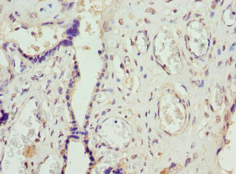 Immunohistochemistry of paraffin-embedded human placenta tissue using FCGRT Antibody at dilution of 1:100