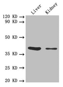 Western blotAll lanes: FCGRT antibody at 1:1000Lane 1: Mouse liver tissueLane 2: Mouse kidney tissueSecondaryGoat polyclonal to rabbit IgG at 1/10000 dilutionPredicted band size: 40 kDaObserved band size: 40 kDa