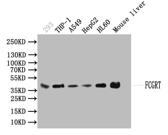 Western blotAll lanes: FCGRT antibody at 1:2000Lane 1: HepG2 whole cell lysateLane 2: Mouse liver tissueLane 3: A549 whole cell lysateSecondaryGoat polyclonal to rabbit IgG at 1/10000 dilutionPredicted band size: 40 kDaObserved band size: 40 kDa