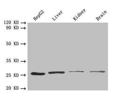 Western blot  | All lanes: PSMA7 antibody at 1.6 µg/ml  | Lane 1: HepG2 whole cell lysate  | Lane 2: Mouse liver tissue  | Lane 3: Mouse kidney tissue  | Lane 4: Mouse brain tissue  | Secondary  | Goat polyclonal to rabbit IgG at 1/10000 dilution  | Predicted band size: 28, 21, 17 kDa  | Observed band size: 28 kDa