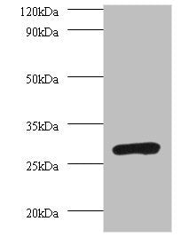 Western blot  | All lanes: PSMA7 antibody at 2µg/ml + 293T whole cell lysate  | Secondary  | Goat polyclonal to rabbit IgG at 1/10000 dilution  | Predicted band size: 28, 21, 17 kDa  | Observed band size: 28 kDa