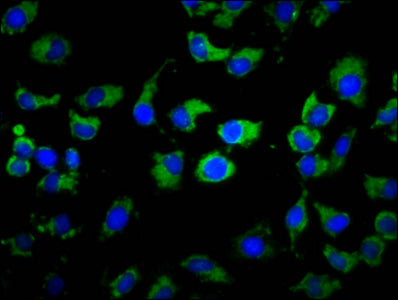 Immunofluorescence staining of A549 cells with MS4A2 Antibody at 1:133, counter-stained with DAPI. The cells were fixed in 4% formaldehyde, permeabilized using 0.2% Triton X-100 and blocked in 10% normal Goat Serum. The cells were then incubated with the antibody overnight at 4°C. The secondary antibody was Alexa Fluor 488-congugated AffiniPure Goat Anti-Rabbit IgG(H+L).