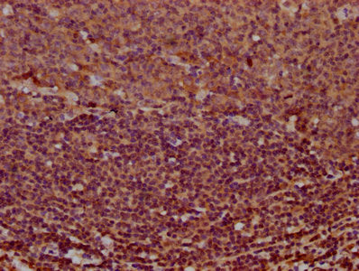 IHC image of MS4A2 Antibody diluted at 1:400 and staining in paraffin-embedded human tonsil tissue performed on a Leica BondTM system. After dewaxing and hydration, antigen retrieval was mediated by high pressure in a citrate buffer (pH 6.0). Section was blocked with 10% normal goat serum 30min at RT. Then primary antibody (1% BSA) was incubated at 4°C overnight. The primary is detected by a biotinylated secondary antibody and visualized using an HRP conjugated SP system.