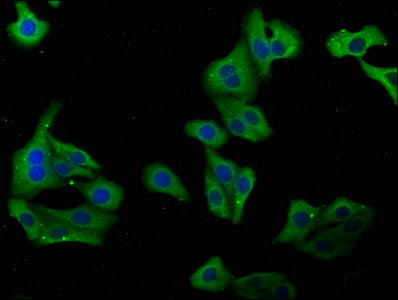 Immunofluorescence staining of HepG2 cells with PLA2G4B Antibody at 1:100, counter-stained with DAPI. The cells were fixed in 4% formaldehyde, permeabilized using 0.2% Triton X-100 and blocked in 10% normal Goat Serum. The cells were then incubated with the antibody overnight at 4°C. The secondary antibody was Alexa Fluor 488-congugated AffiniPure Goat Anti-Rabbit IgG(H+L).