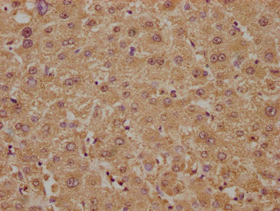 IHC image of PLA2G4B Antibody diluted at 1:300 and staining in paraffin-embedded human liver tissue performed on a Leica BondTM system. After dewaxing and hydration, antigen retrieval was mediated by high pressure in a citrate buffer (pH 6.0). Section was blocked with 10% normal goat serum 30min at RT. Then primary antibody (1% BSA) was incubated at 4°C overnight. The primary is detected by a biotinylated secondary antibody and visualized using an HRP conjugated SP system.