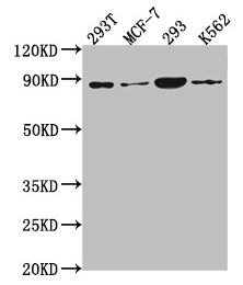 Western Blot | Positive WB detected in: 293T whole cell lysate, MCF-7 whole cell lysate, 293 whole cell lysate, K562 whole cell lysate | All lanes: P0C869 antibody at 1:2000 | Secondary | Goat polyclonal to rabbit IgG at 1/50000 dilution | Predicted band size: 88, 101, 55, 115 kDa | Observed band size: 88 kDa