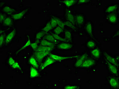 Immunofluorescent analysis of Hela cells using PSMA3 Antibody at dilution of 1:100 and Alexa Fluor 488-congugated AffiniPure Goat Anti-Rabbit IgG(H+L)