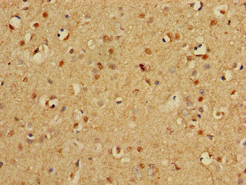 Immunohistochemistry of paraffin-embedded human brain tissue using PSMA3 Antibody at dilution of 1:100