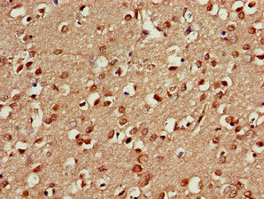 Immunohistochemistry of paraffin-embedded human brain tissue using PSMA5 Antibody at dilution of 1:100