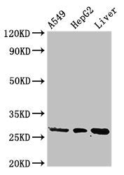 Western Blot | Positive WB detected in: A549 whole cell lysate, HepG2 whole cell lysate, Rat liver tissue | All lanes: PSMA5 antibody at 3μg/ml | Secondary | Goat polyclonal to rabbit IgG at 1/50000 dilution | Predicted band size: 27, 21 kDa | Observed band size: 27 kDa