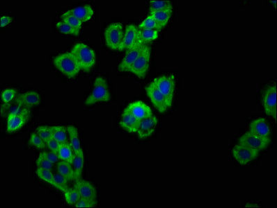 Immunofluorescence staining of HepG2 cells with SLAMF6 Antibody at 1:66, counter-stained with DAPI. The cells were fixed in 4% formaldehyde, permeabilized using 0.2% Triton X-100 and blocked in 10% normal Goat Serum. The cells were then incubated with the antibody overnight at 4°C. The secondary antibody was Alexa Fluor 488-congugated AffiniPure Goat Anti-Rabbit IgG(H+L).