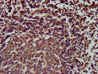 IHC image of SLAMF6 Antibody diluted at 1:200 and staining in paraffin-embedded human lymph node tissue performed on a Leica BondTM system. After dewaxing and hydration, antigen retrieval was mediated by high pressure in a citrate buffer (pH 6.0). Section was blocked with 10% normal goat serum 30min at RT. Then primary antibody (1% BSA) was incubated at 4°C overnight. The primary is detected by a biotinylated secondary antibody and visualized using an HRP conjugated SP system.