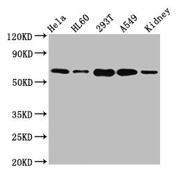 Western Blot | Positive WB detected in: Hela whole cell lysate, HL60 whole cell lysate, 293T whole cell lysate, A549 whole cell lysate, Mouse kidney tissue | All lanes: SLAMF6 antibody at 5.1μg/ml | Secondary | Goat polyclonal to rabbit IgG at 1/50000 dilution | Predicted band size: 38, 25 kDa | Observed band size: 60 kDa